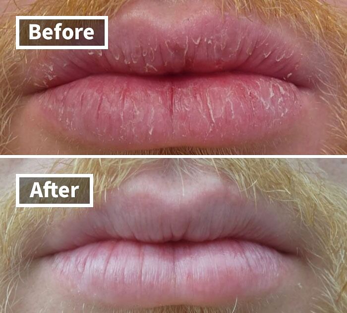 Cracked Lips? O’Keeffe’s Lip Repair Does the Night Shift So You Don’t Have To