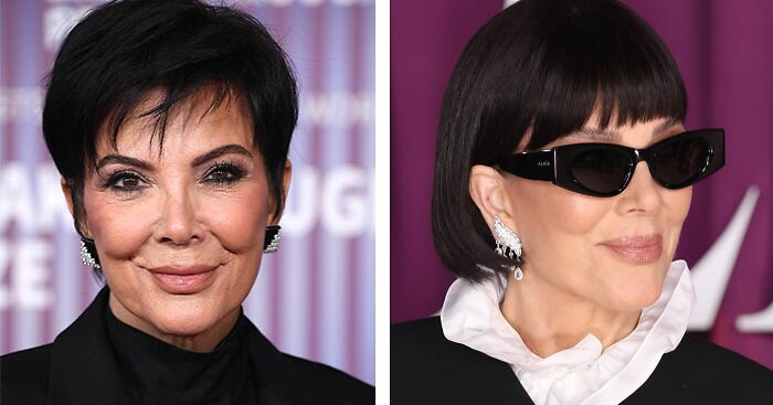 5 Facelift Red Flags You’ll Totally Want to Dodge