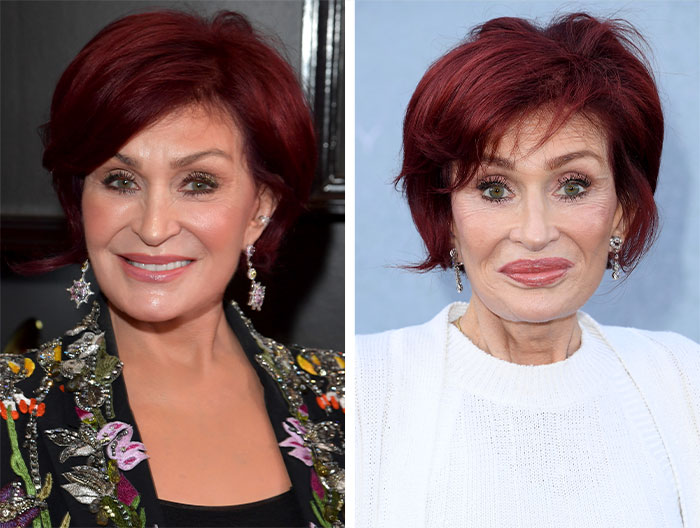 Photos Can Lie, So Hunt Down Patient Videos