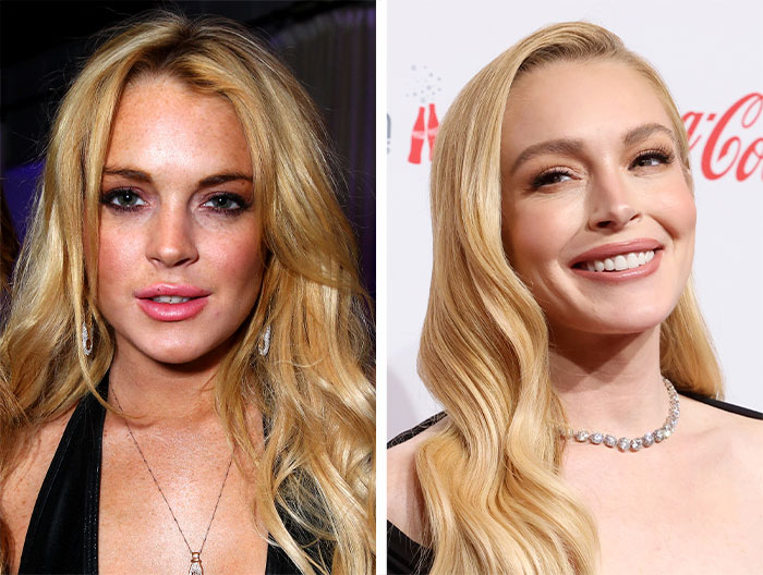 When Facelifts Work, They’re Like a Time Machine for Your Face