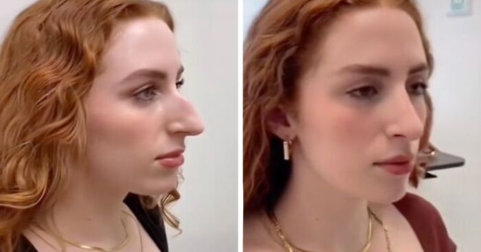 Wait Till You See These Plastic Surgery Before-And-Afters!