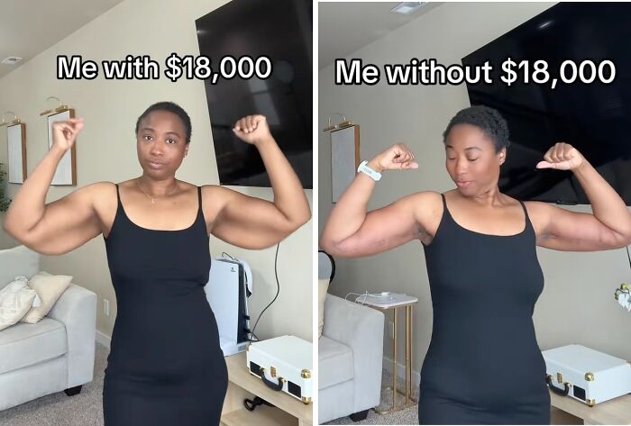 Wait Till You See These Plastic Surgery Before-And-Afters!