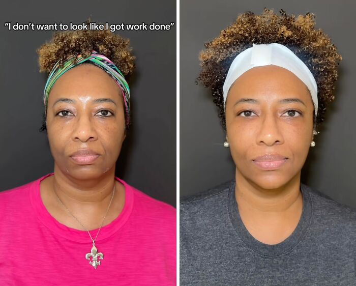 Wait Till You See These Plastic Surgery Before-And-Afters!