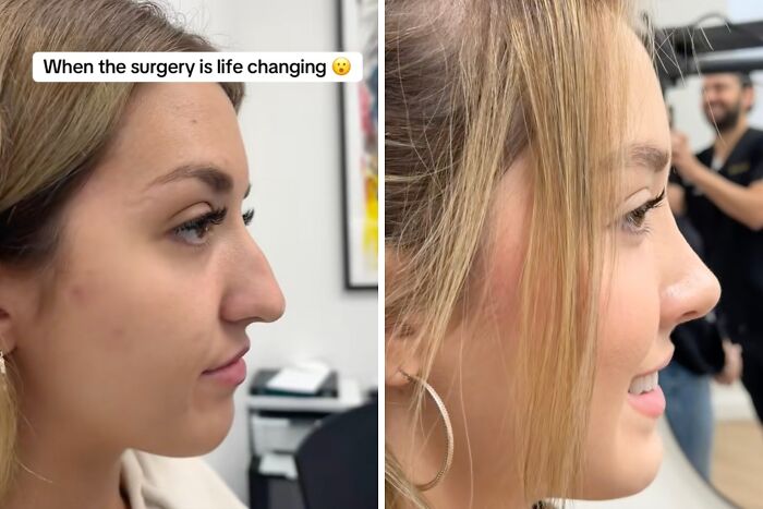 Wait Till You See These Plastic Surgery Before-And-Afters!