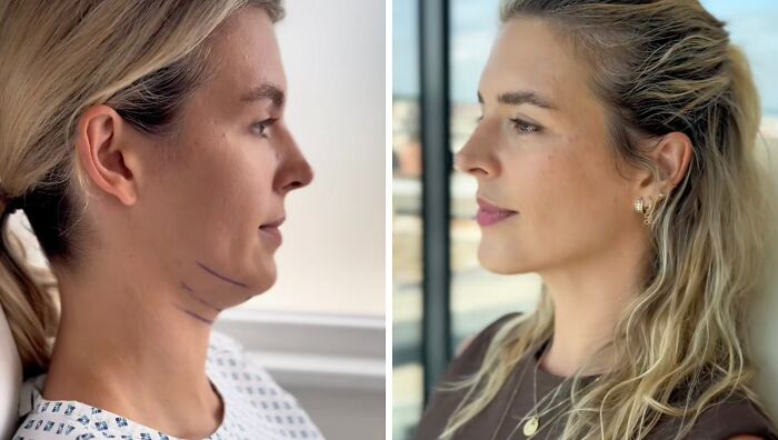 Wait Till You See These Plastic Surgery Before-And-Afters!