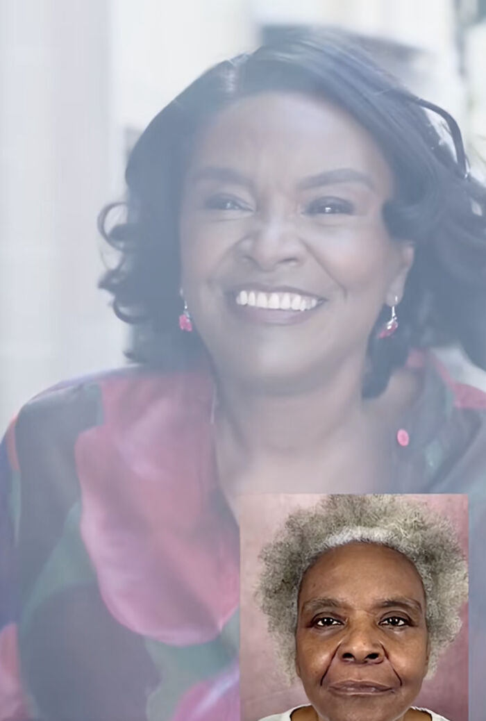 Wait Till You See These Plastic Surgery Before-And-Afters!