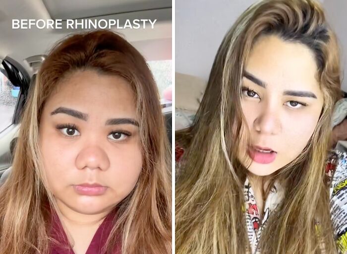 Wait Till You See These Plastic Surgery Before-And-Afters!