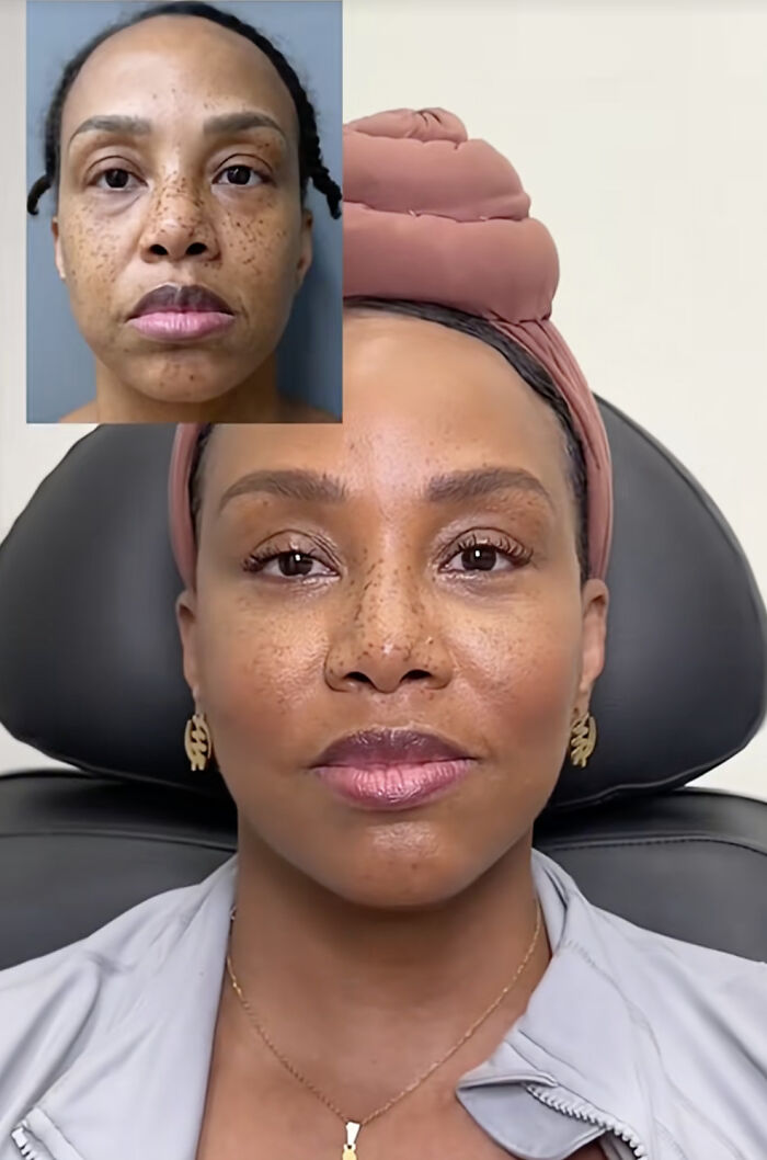 Wait Till You See These Plastic Surgery Before-And-Afters!