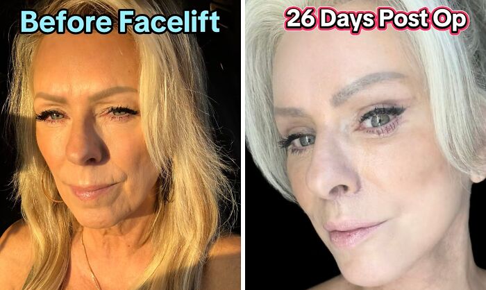 Wait Till You See These Plastic Surgery Before-And-Afters!
