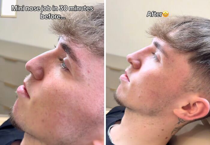 Wait Till You See These Plastic Surgery Before-And-Afters!