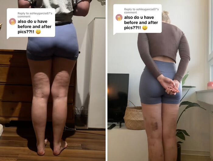 Wait Till You See These Plastic Surgery Before-And-Afters!