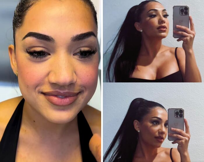 Wait Till You See These Plastic Surgery Before-And-Afters!