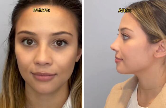 Wait Till You See These Plastic Surgery Before-And-Afters!
