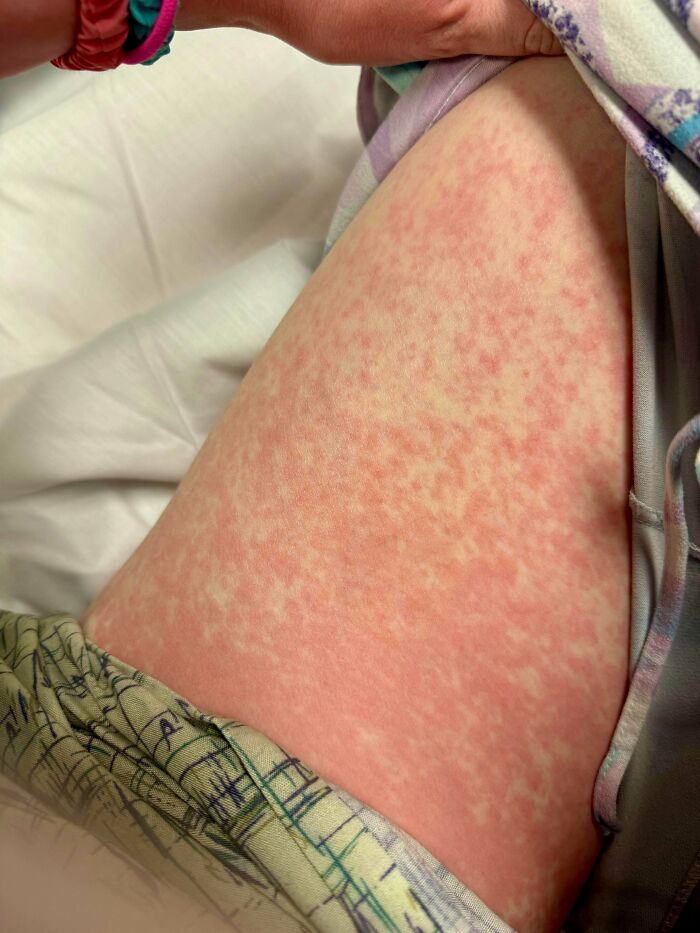 That Time I Almost Didn’t Make It Through An MRI