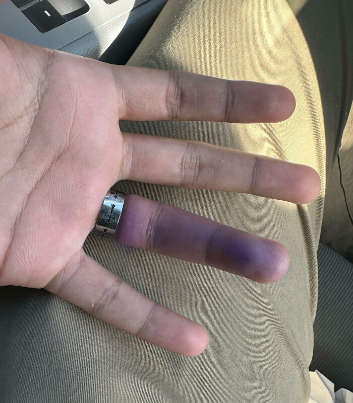 The 'Never Try Someone Else’s Rings' Lesson