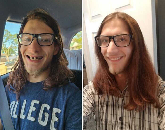 Got Rid Of Tooth Pain, Gained A Smile