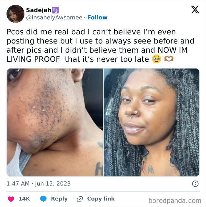 Not Alone, Glow-Up Edition