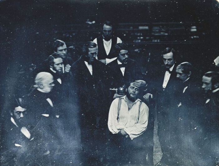 Caught On Camera: Early Anesthesia, 1847