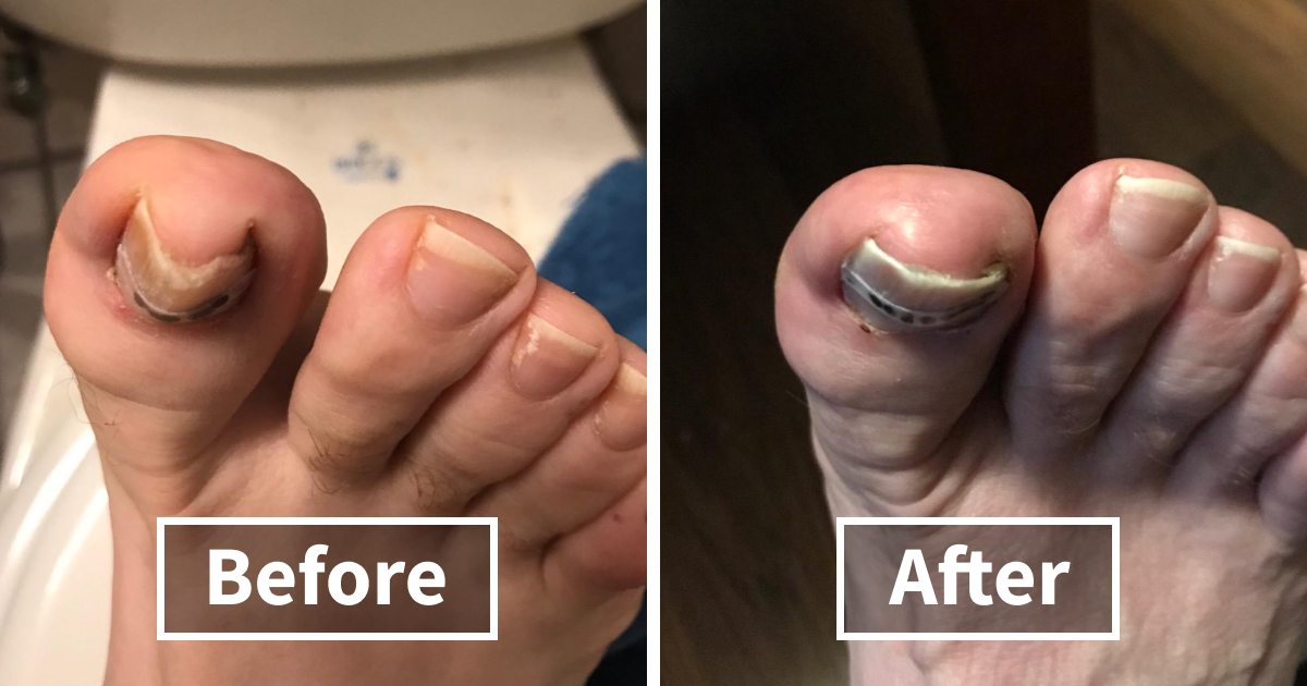 22 Winter Beauty Hacks That’ll Fix Your Face And Not Make You Want To Cry