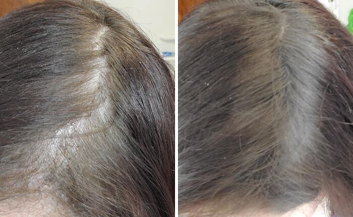 Post-Beanie Hair Freakout? Nope, Because Gowwim Hairline Powder Has You Covered.