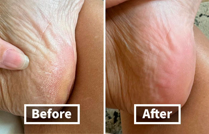 Say Bye-Bye To Rough Winter Heels With The Gentle Glass Foot File Callus Remover.