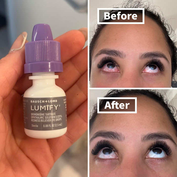 Got Red, Dry Eyes? Lumify Redness Reliever Eye Drops To The Rescue!