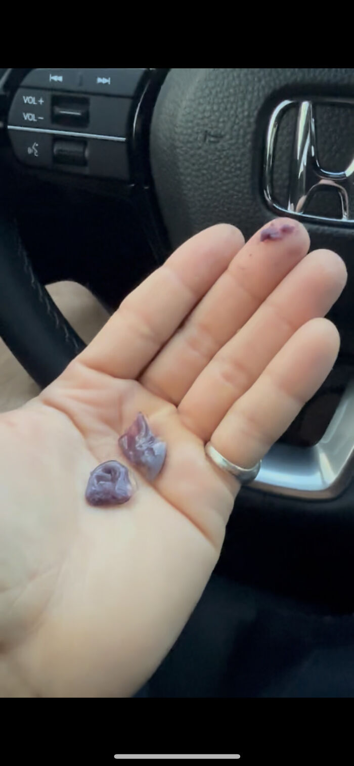 Purple Jelly Blobs In My Water Bottle? What Even Are These?