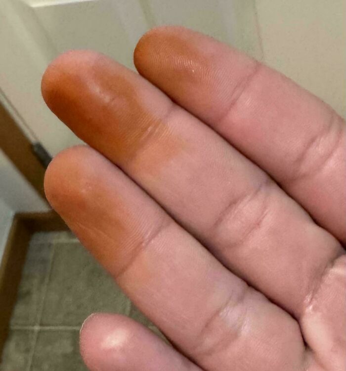 Burnt My Fingers On Stove – Now They Smell Like Hot Dogs?