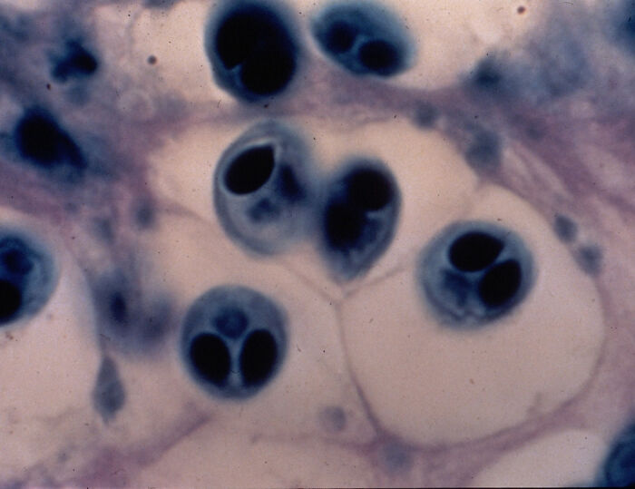 Myxobolus Shekel: The Microscopic Champion