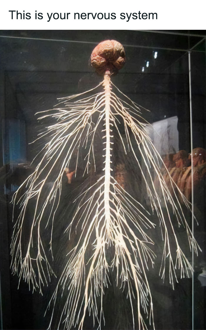 Check Out This Full Nervous System Dissection Display—Gross and Cool!