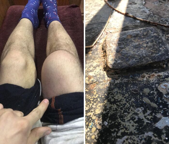 Banged My Knee Hard Against a Metal Edge. Didn’t Cry, But You Might!