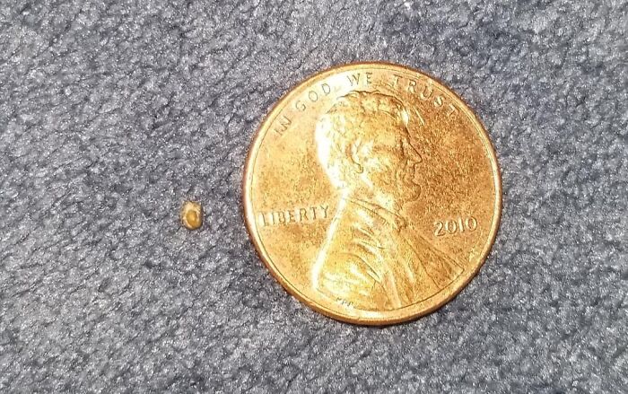 My Little Kidney Stone Buddy Passed On January 1st—Adorable, Right?