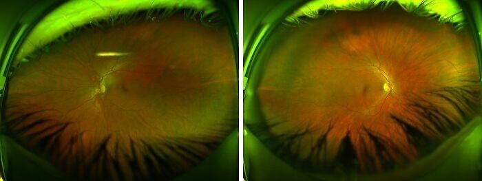 Optometrist’s Fancy New Eye Camera Shots—Mind Blown