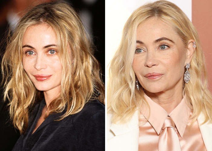 Emmanuelle Béart: Oops, The Lip Job That Went Wrong