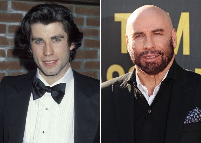 John Travolta: The Bald and Bold Journey