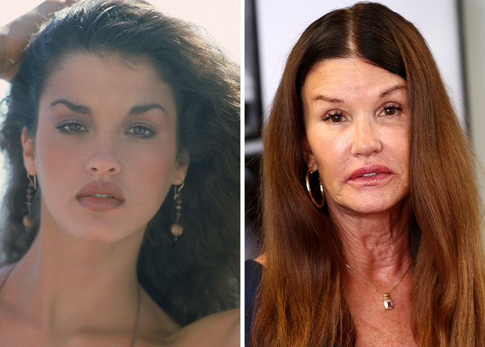 Janice Dickinson: The Supermodel Who’s Never Afraid to Tweak