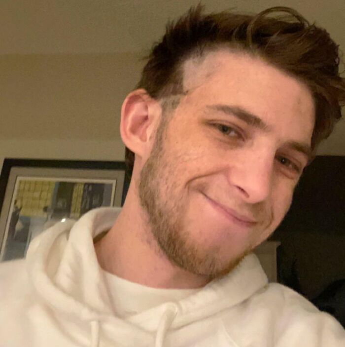 DIY Haircut Took a Turn for the Worse