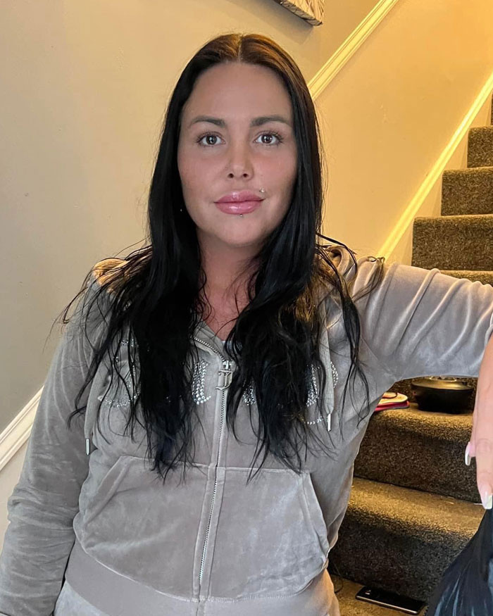 Alice Webb’s Non-Surgical Nightmare