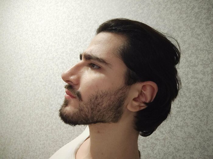 6 Months In, Looking A Bit Like Lord Farquaad