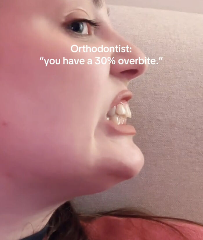 The 40 Most Delightfully Imperfect Pics You Didn't Know You Needed