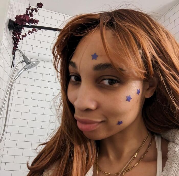 That Pesky Pimple Just Got Fashionable With Star Pimple Patches