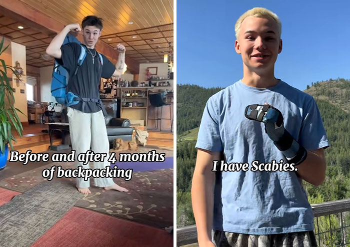 Wait Till You See These 30 Backpackers' Before and After Travel Pics—It's Wild!