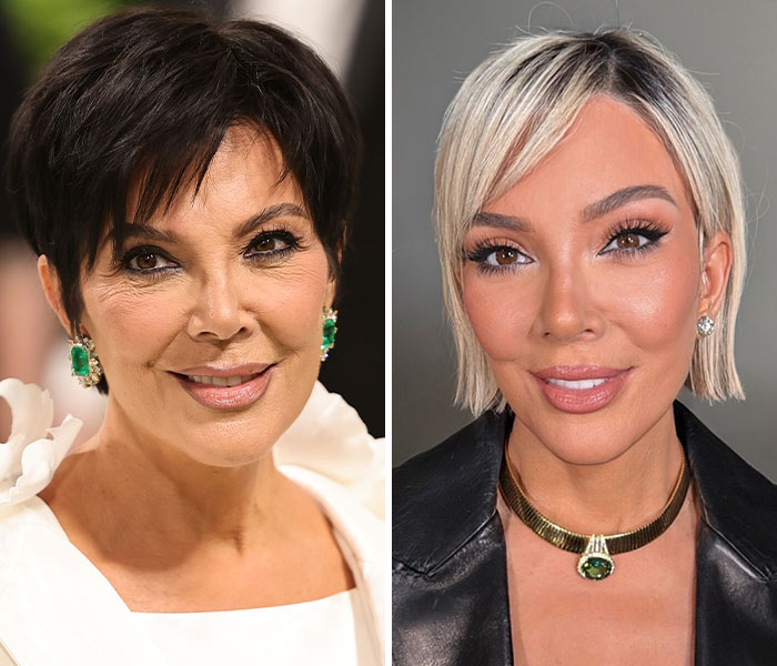 Kris Jenner’s Look-Too-Good Facelift