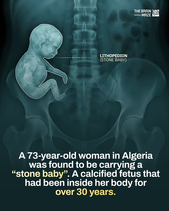 20 Mind-Blowing Body Facts That Will Totally Surprise You