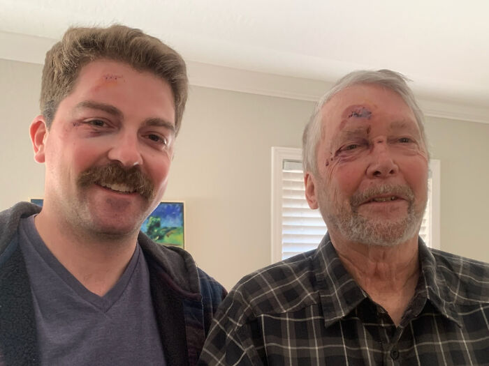 Dad and Kid: Falling Buddies with Matching Stitches