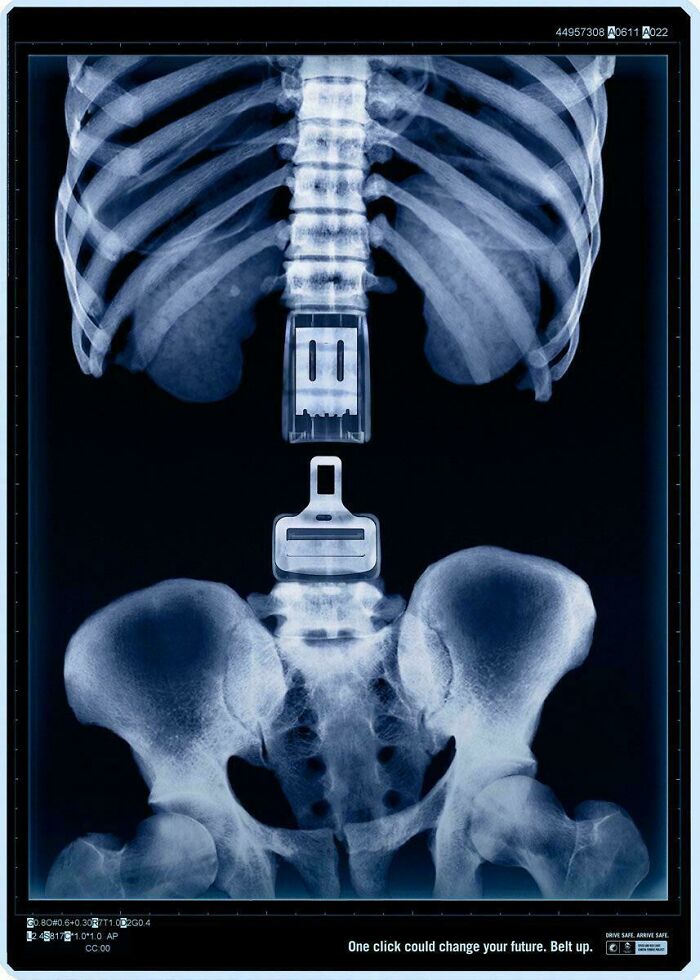 Click That Seatbelt: Save Your Life!