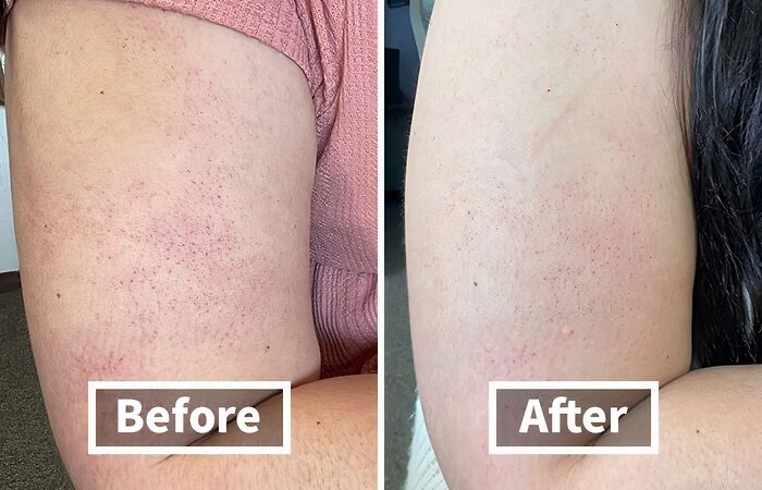 If Your Arms Feel Like The Moon, Try This Scrub That Everyone Swears By