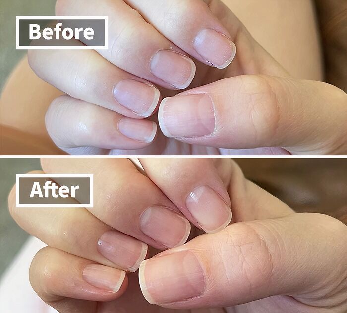 Nail Your Nail Game With This Cuticle Oil That Works Wonders