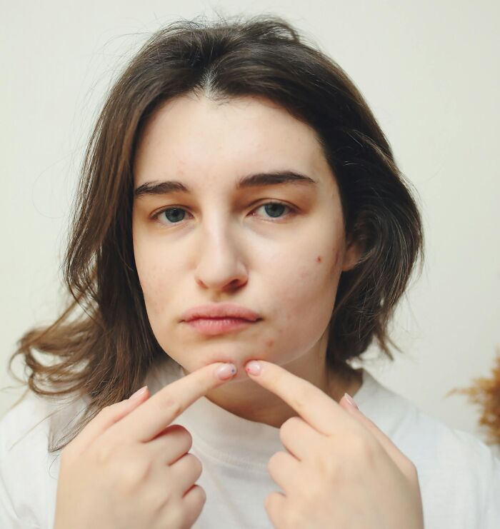 Got Way Too Much Satisfaction Popping Pimples