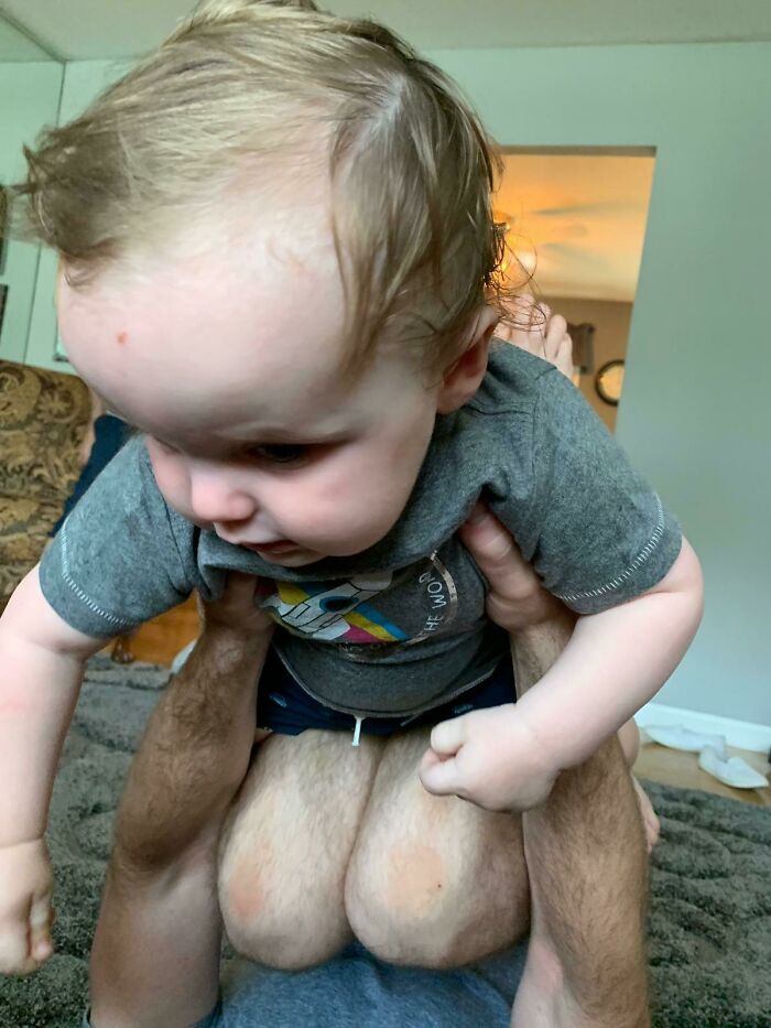 My Nephew Stole His Dad’s Legs (Or Did He?)
